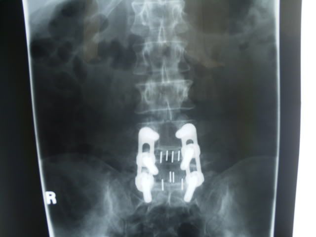 backX-rays001.jpg