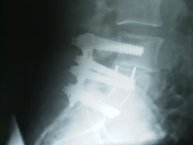 backX-rays007.jpg