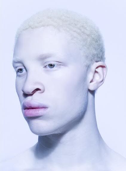 afro albino