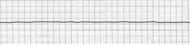 What Walski's EKG would probably look like right now, image hosting by Photobucket